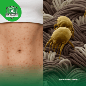 Lee más sobre el artículo 🛏️ ¿Tienes alergias o irritaciones en la piel? Podrían ser ácaros del polvo (y así puedes eliminarlos)